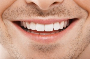 faccette dentali